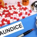 27 test positive for jaundice in Anantnag village